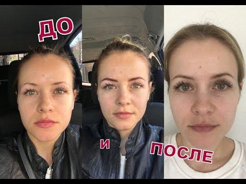 МИКРОБЛЕЙДИНГ! ДО И ПОСЛЕ! ТЕНЕВАЯ ТЕХНИКА!