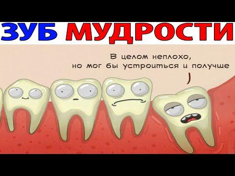 Лютые приколы. ЗУБ МУДРОСТИ. Тест на психику
